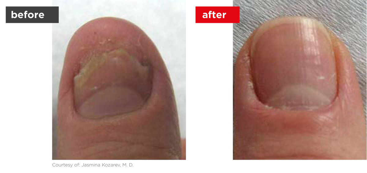 ClearSteps-Before_After-1 ClearSteps-Before_After-1