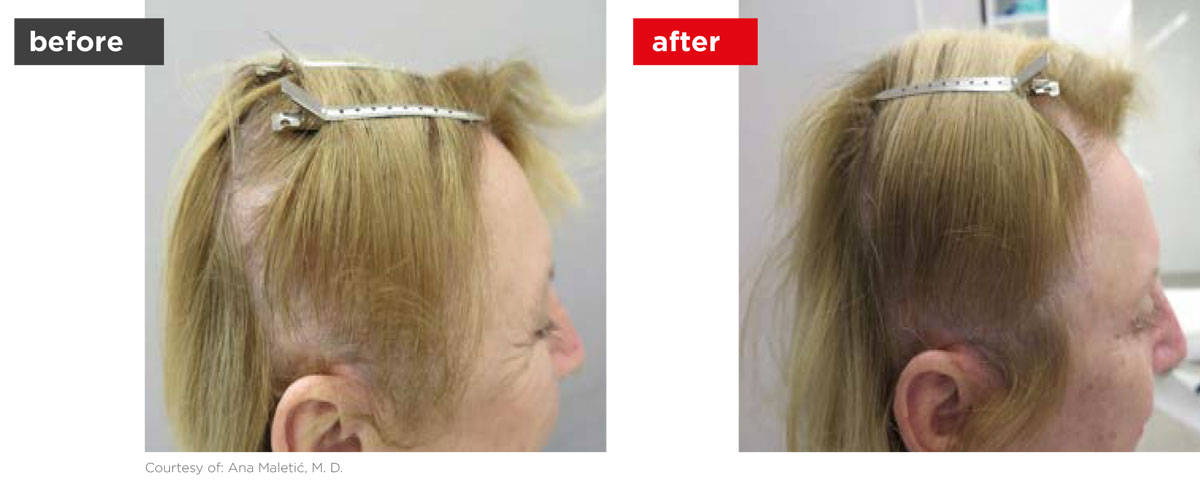 HaiRestart-Before_After-1 HaiRestart-Before_After-1