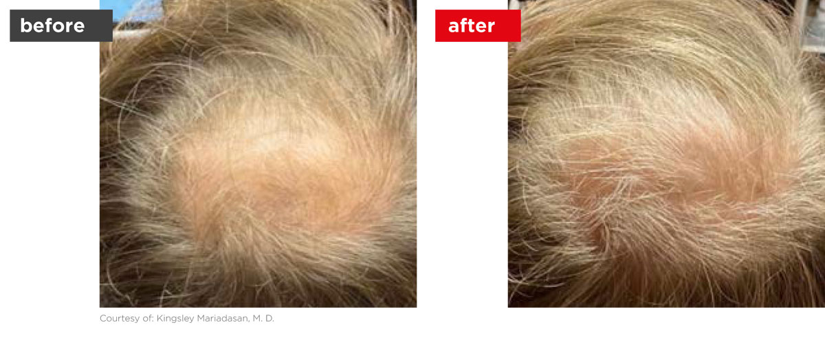 HaiRestart-Before_After-2 HaiRestart-Before_After-2