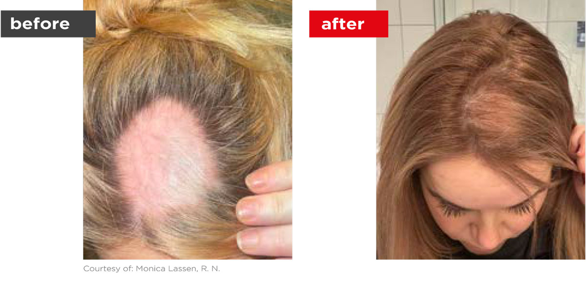 HaiRestart-Before_After-3 HaiRestart-Before_After-3