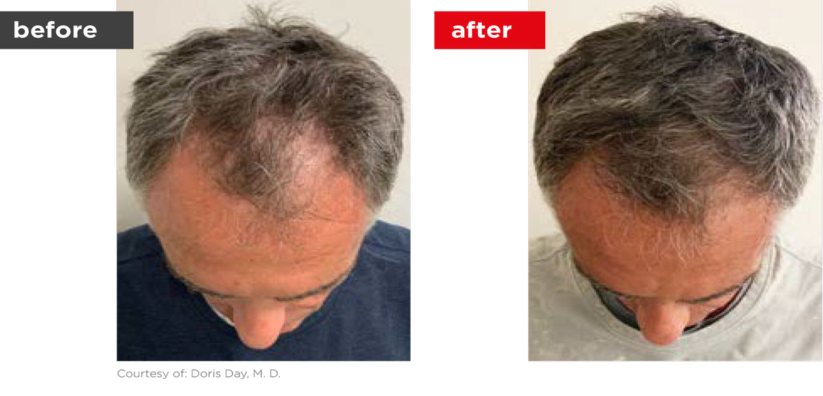 HaiRestart-Before_After-4 HaiRestart-Before_After-4