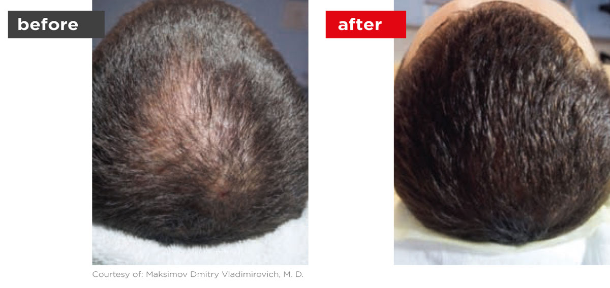 HaiRestart-Before_After-5 HaiRestart-Before_After-5