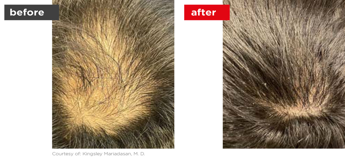 HaiRestart-Before_After-6 HaiRestart-Before_After-6