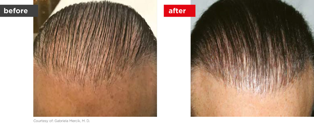 HaiRestart-Before_After-7 HaiRestart-Before_After-7