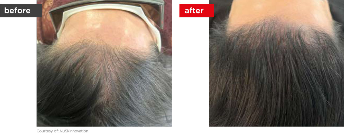 HaiRestart-Before_After-8 HaiRestart-Before_After-8