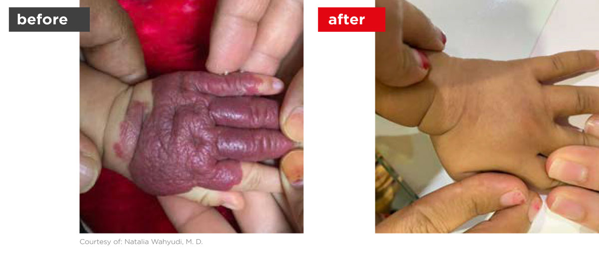 Veins-Before_Afters-6 Veins-Before_Afters-6